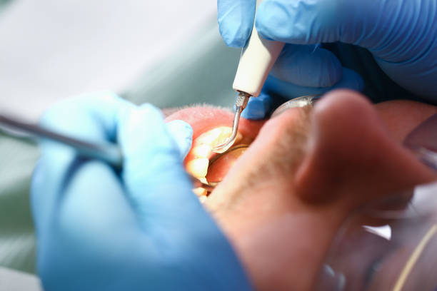 Best Pediatric Emergency Dentist in Cherokee, NC
