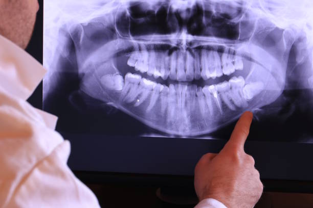 Best Weekend Emergency Dentist in Cherokee, NC